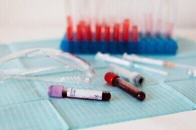 What Are the Stages of Blood Sample Processing?