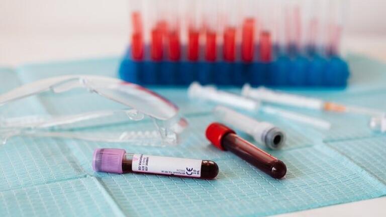 What Are the Stages of Blood Sample Processing?