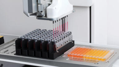 HLA Typing: How accurate is your pipetting robot?