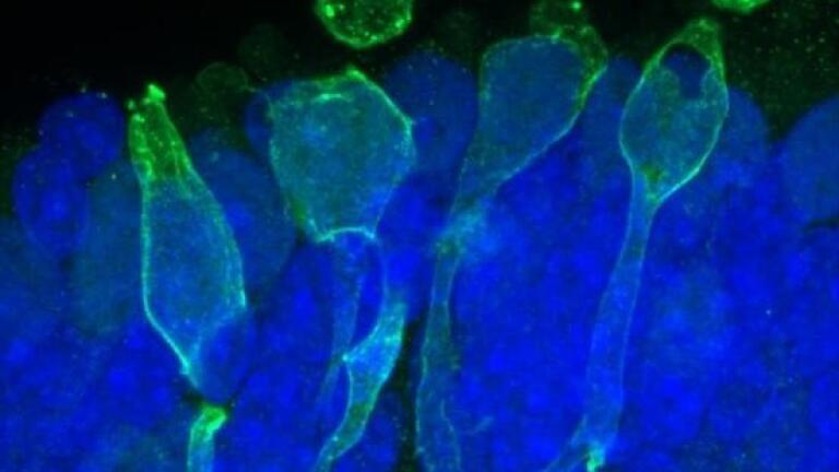 Retinal organoids grown on Lipidure-coated plate. (courtesy: Dr Valeria Chichagova (Newcells Biotech) and Professor Lako (Newcastle University)