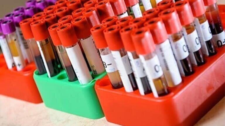 High quality, ethically sourced biofluid samples