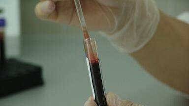 What Is a Patient-Derived Model?