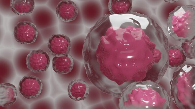 What Is a Tumour Growth Model?