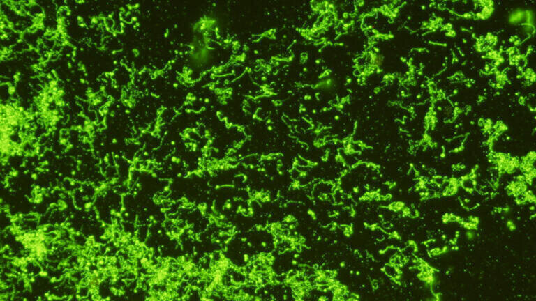 New Leptospira Monoclonal Antibodies