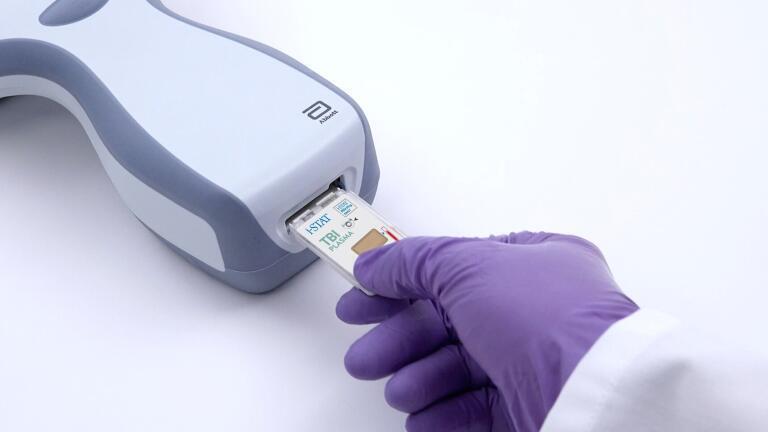 Brain Injury Test Achieves CE Mark