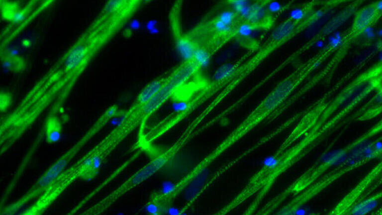 Skeletal muscle differentiation kits.