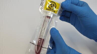 Reducing the Volume of Single Use Plastic in Healthcare