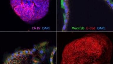 Gastrointestinal Organoid Biobank