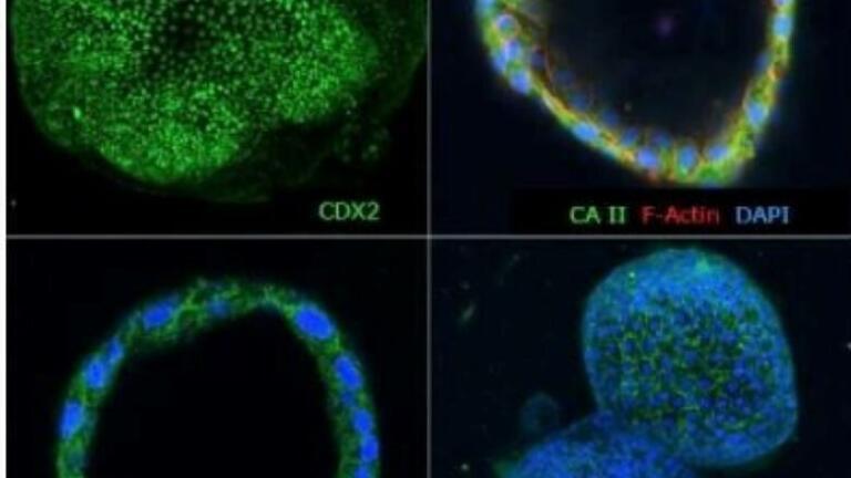 Immunocytochemical characterisation of human colon organoids (Colon-87, SCC321). Human colon PDOs are positive for colon-specific markers: CA II, posterior hindgut marker: CDX2, stem cell markers: Lgr5 and Sca1.