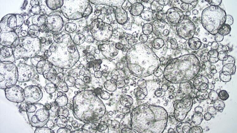 Patient-derived colon organoids from normal (SCC321) patient cultured in L-WRN conditioned media (SCM105) for five passages.
