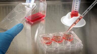 What Are the Different Pipetting Techniques?
