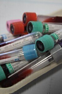 Blood test detection of Cancer through Metabalomics Analysis