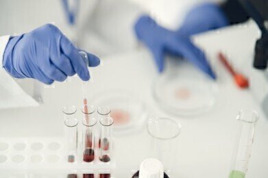 The Importance of Accurate Pipetting