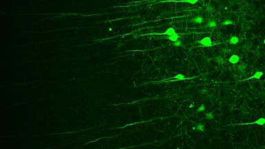 Fibre Lasers for 2-photon Microscopy and Optogenetics