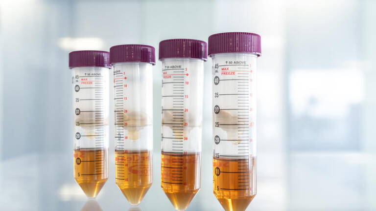 Results after filtration in a centrifuge.