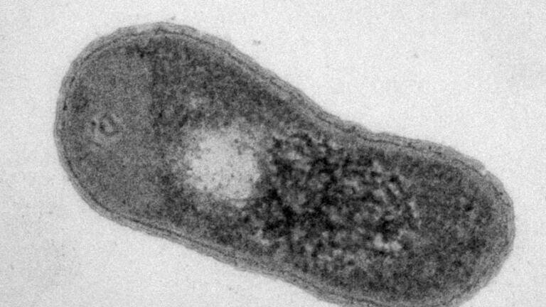 TEM image of Bacterium Gemmatimonas phototrophica – (courtesy: Jason Dean BSc. from the Institute of Microbiology, Czech Academy of Sciences, Trebon)