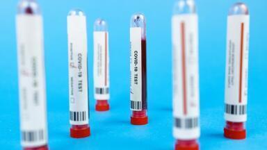 Sample Transportation in Laboratory Explained
