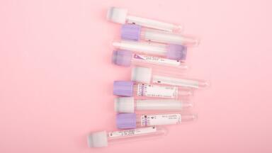What Are the Rules for Sample Transportation?