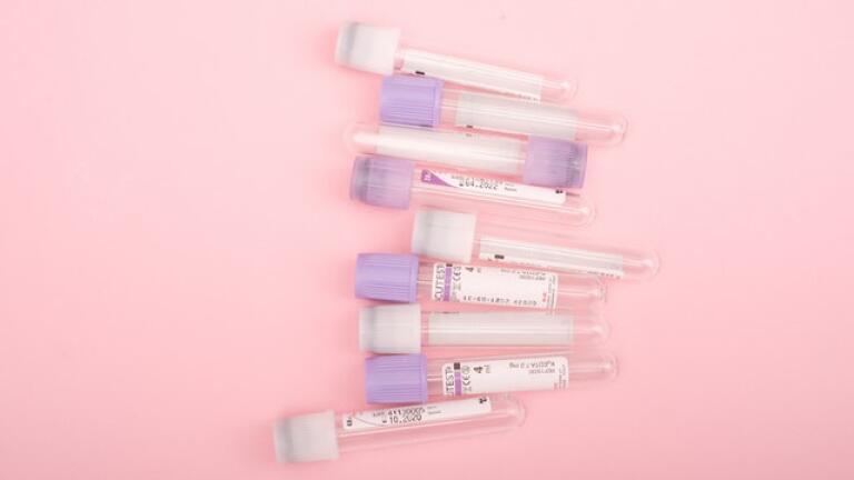 What Are the Rules for Sample Transportation?