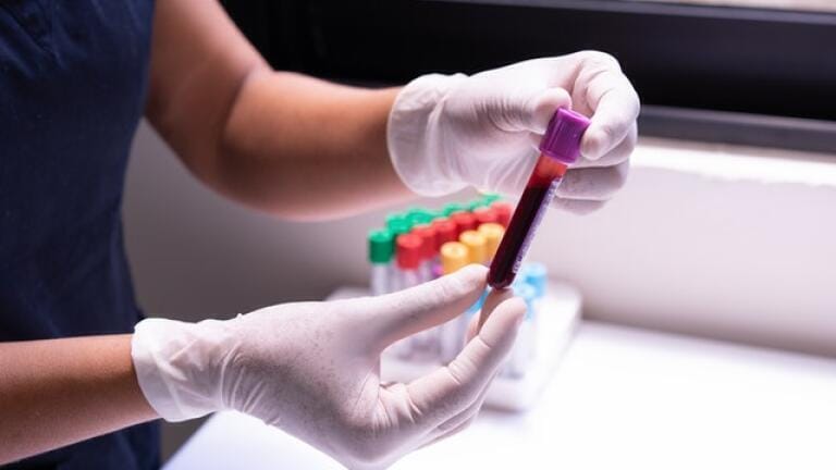 How Are Blood Samples Transported? 