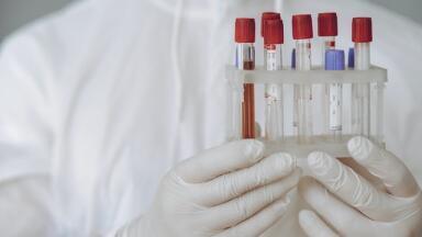 What's the Right Temperature for Transporting Samples?