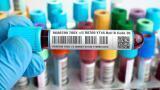 Durable medical labels for the medical industry