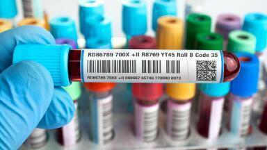 Durable medical labels for the medical industry