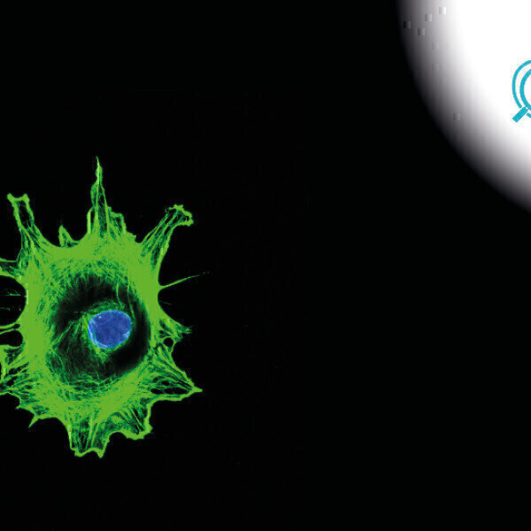 Single Cell Sequencing Service for Oncology and Immunology Labmate Online - Vimarsana News