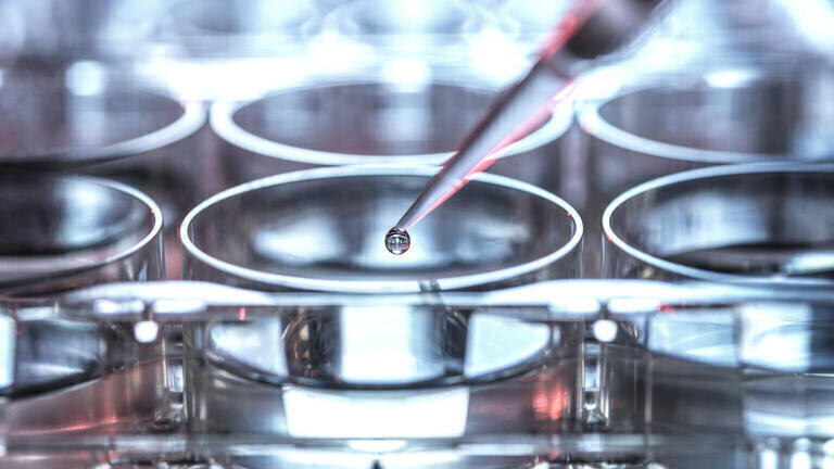 Diamond celebrates Transformational Upgrade and Picture History