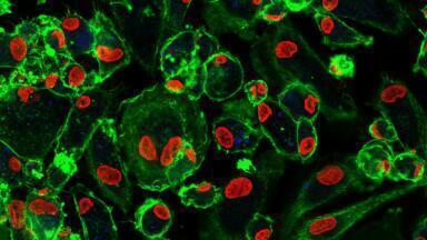 How do Immune cells impact on antibiotic treatments for TB?