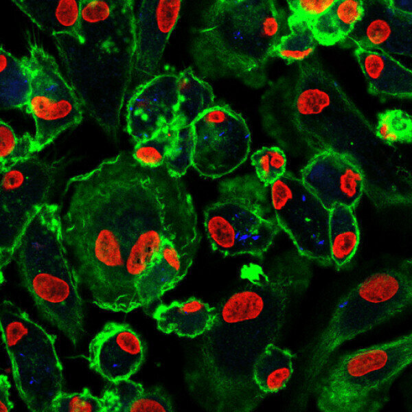How do Immune cells impact on antibiotic treatments for TB? - Vimarsana News