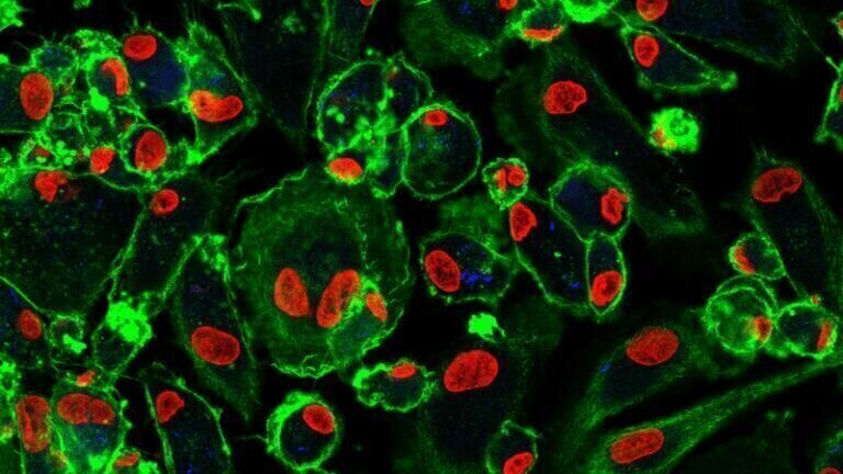 How do Immune cells impact on antibiotic treatments for TB?