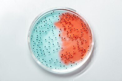 Bacteria in Food - Types, Testing & Problems