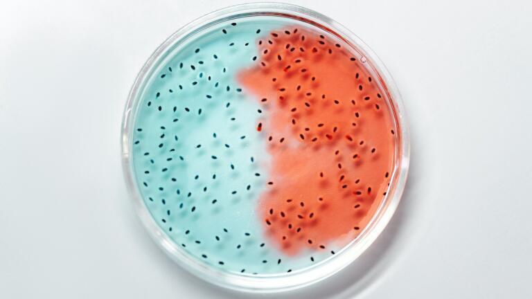 Bacteria in Food - Types, Testing & Problems