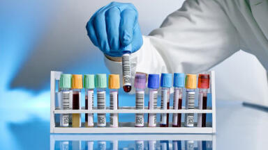 The Importance of Labels in Laboratory Testing