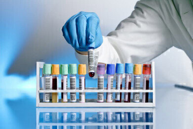 The Importance of Labels in Laboratory Testing
