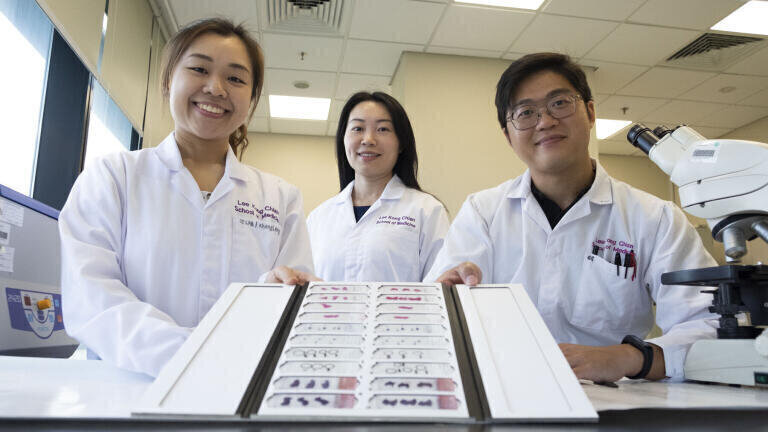Study Pinpoints how Fatty Liver Disease Increases Vascular Disease Risk