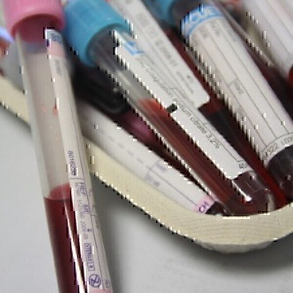 UK Study aims to set new NHS Healthcare Guidance - Vimarsana News