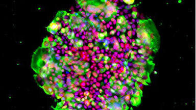 Expanded Range of Laminin isoforms