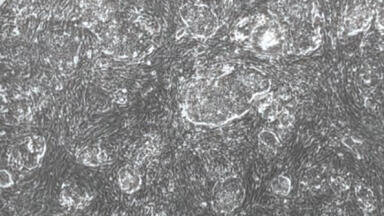 iPS-Cell Based Cell Therapies for Genetic Skin Disease