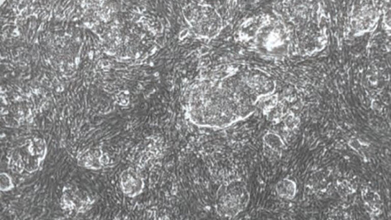 iPS-Cell Based Cell Therapies for Genetic Skin Disease