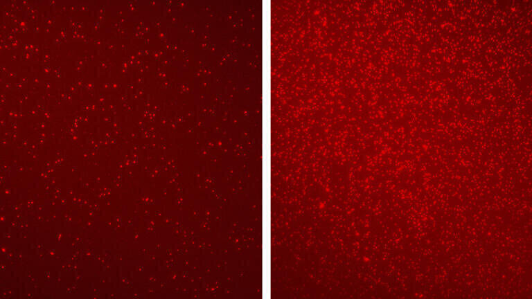 Different patterns of epigenetic markers revealed by EPINUC on blood nucleosomes (bright-red dots) of a healthy person (left) and a colorectal cancer patient (right)