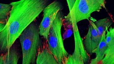 Fast Creation of Custom Cell Lines