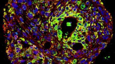 Organoid Cryopreservation Handbook