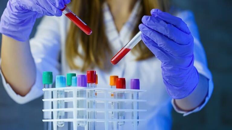 Challenges of Lab Data Management