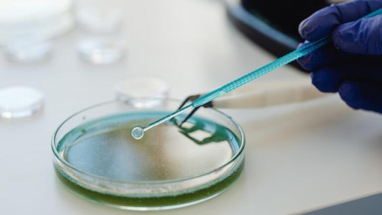 What Are the Different Types of Bioprocesses?