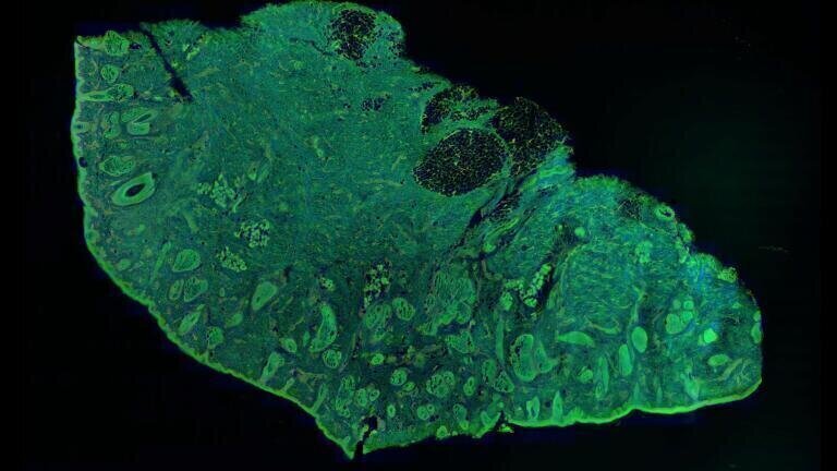 Magnification: Green is a fluorescent protein stain, red is a DNA stain, and blue is SHG in ordered Collagen tissue. DNA clusters in cell nuclei, proteins cluster in cell bodies, and collagen fibres form connective tissue in the skin sample. 
© Professor Michael Giacomelli/University of Rochester