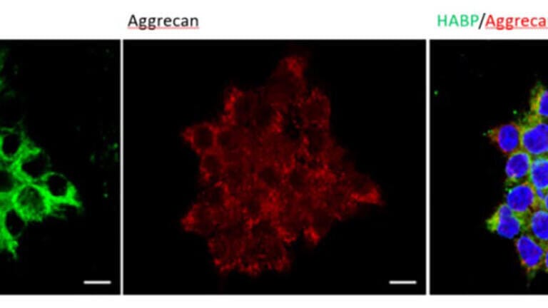 The staining of HA (using biotinylated HABP from AMSBIO, 1:200) and aggrecan to reveal the pericellular matrix on the human embryonic kidney cells, induced to express PNN components. 
