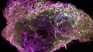 Bone Marrow technology set to improve Anti-Cancer Therapies