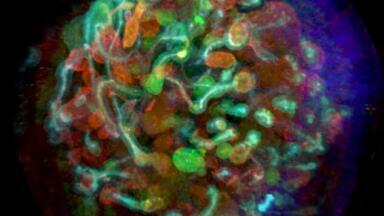 Advanced Technology for Creating Vascularised Kidney Organoids